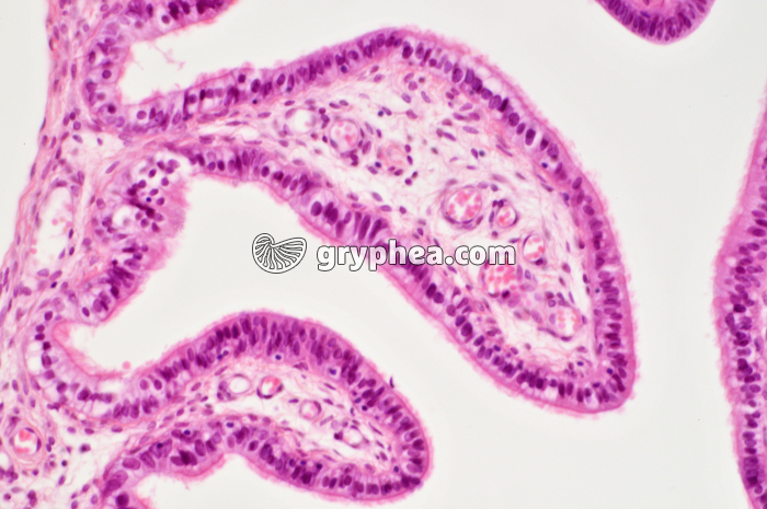 Trompe de Fallope x100 - gryphea.com